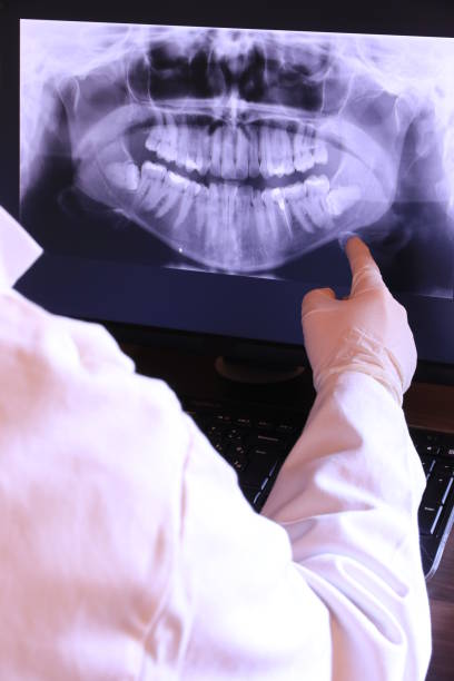 Best Urgent Care for Lost Fillings or Crowns in Johnson Creek, WI