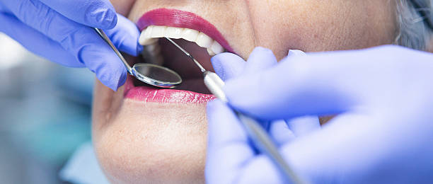 Best Urgent Care for Lost Fillings or Crowns in Johnson Creek, WI